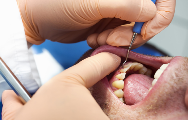 img-paniz-servizi-11